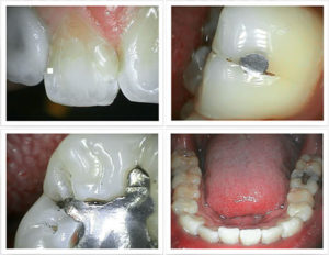 photo-for-intraoral-imaging-page